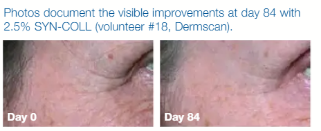 Multi-Peptide Rejuvenating Skin Repair Cream ingredient study